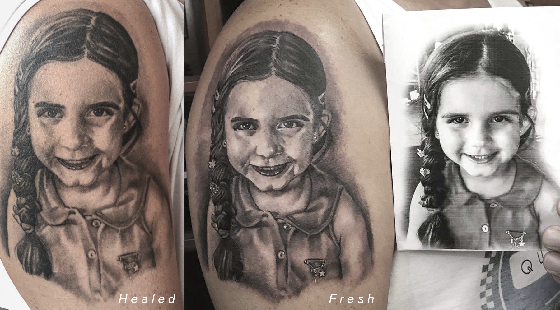 10d_0wgalvnijqplw-izy6a Retrato de criança em tatuagem no braço, comparando versões cicatrizada, recente e a foto original preto e branco.