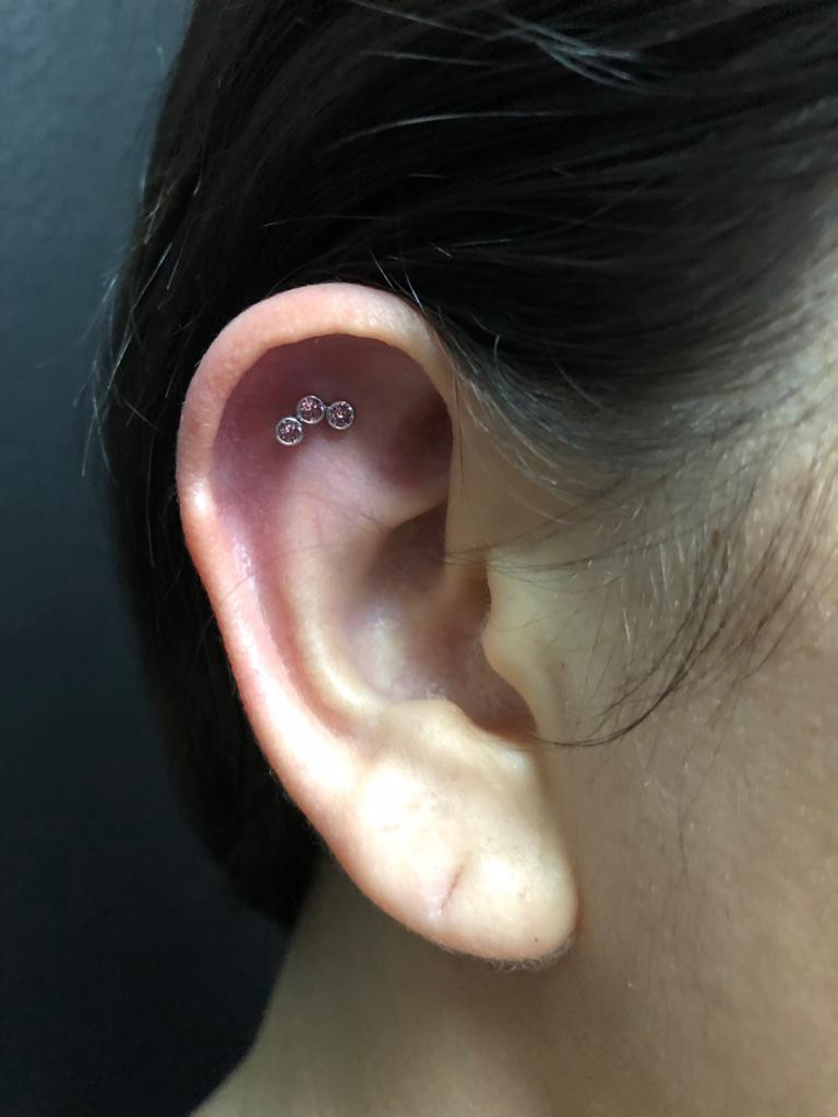 1weiptck9sbmxvictyy0jpq