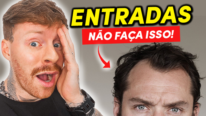 entradas-no-cabelo-cortes-masculinos entradas no cabelo cortes masculinos