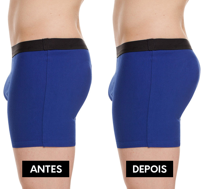 antes-depois-cueca-com-enchimento antes depois cueca com enchimento