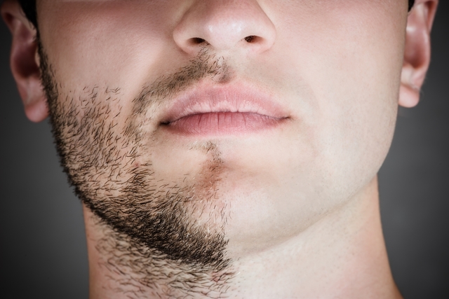 minoxidil_como_usar_na_barba_sobrancelha_e_cabelo_e_quais_os_efeitos_colaterais_55_l