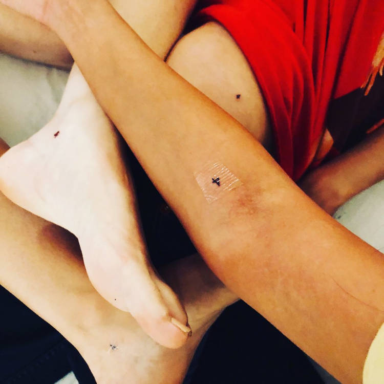 Foto de braços e pernas com a tatuagem número "4"