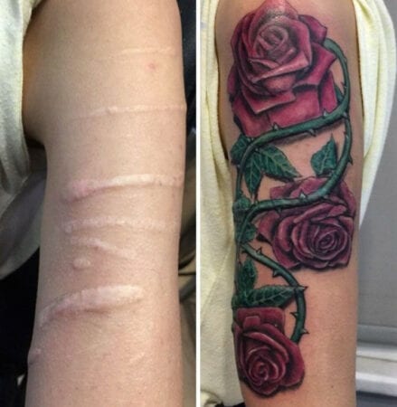 antes e depois de tatuagem de rosa em cicatriz 439x450 1