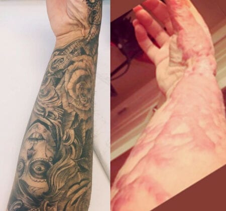tattoos disfarcam cicatriz 450x421 1