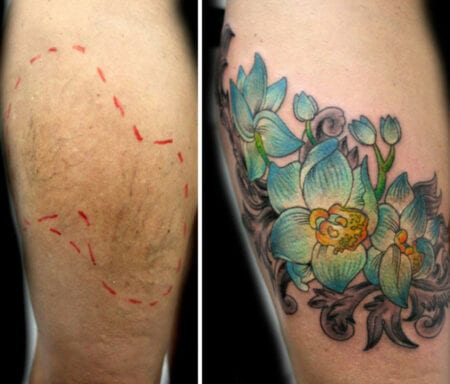 tatuagem cobre cicatriz 450x384 1