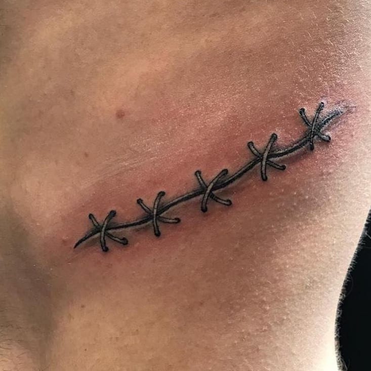 Tattoo de pesponto cobre cicatriz na barriga