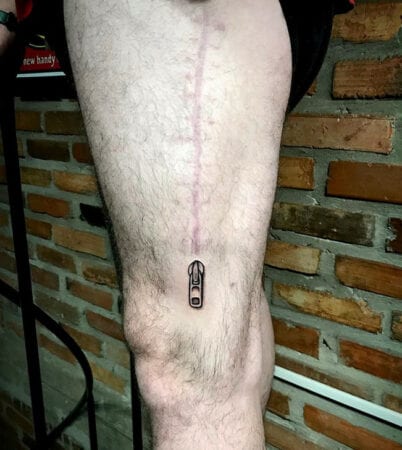 tatuagem de ziper cobre cicatriz 402x450 1