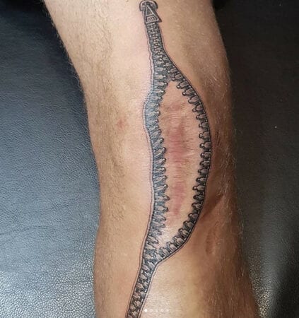 tatuagem de ziper disfarca cicatriz grande no joelho 423x450 1