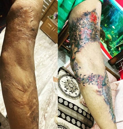 tatuagem para cobrir cicatriz grande no braco 429x450 1